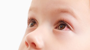 Xuất huyết mắt là gì? Nguyên nhân, dấu hiệu và cách xử lý