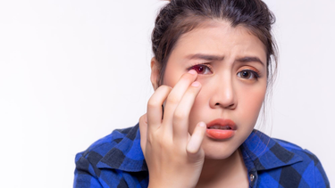 Xuất huyết mắt có nguy hiểm không? Dấu hiệu nhận biết và cách xử lý an toàn