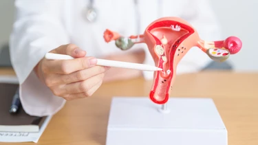 U nang buồng trứng ở tuổi dậy thì là gì? Dấu hiệu nhận biết sớm