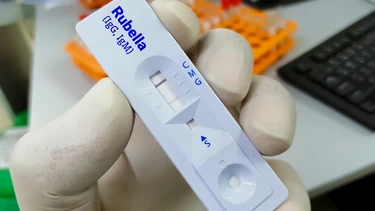Rubella IgG dương tính là gì? Ý nghĩa của kết quả xét nghiệm