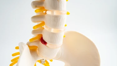 Các bài tập cho phồng đĩa đệm tại nhà và những lưu ý cần biết