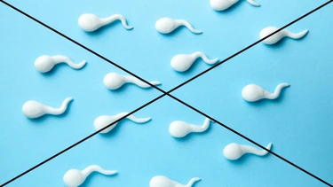 Không có tinh trùng là gì? Những điều cần biết về không có tinh trùng