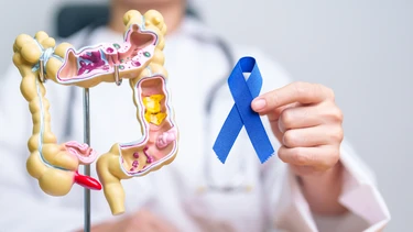 Ung thư trực tràng giai đoạn 2​ là gì? Nguyên nhân, triệu chứng và cách điều trị
