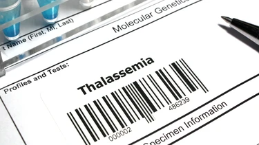 Chi phí sàng lọc phôi thalassemia​ bao nhiêu? Khi nào cần thực hiện sàng lọc thalassemia?