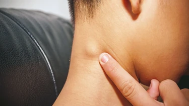 Hạch lành tính ở cổ: Dấu hiệu, nguyên nhân và cách phòng ngừa