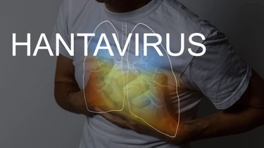 Hội chứng phổi do virus Hanta: Tác nhân, dấu hiệu và mức độ nguy hiểm