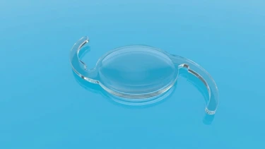 Mổ đục thủy tinh thể được mấy lần? Khi nào cần can thiệp?