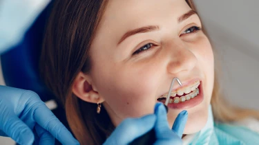 Niềng răng có đau không? Cách giảm đau khi niềng răng