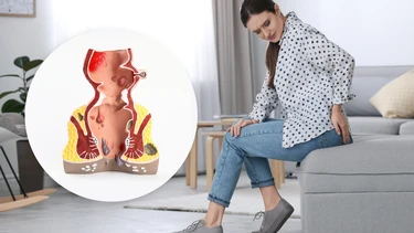 Nổi hạch gần hậu môn có nguy hiểm không? Nguyên nhân và cách chẩn đoán