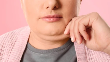 Nọng cằm hình thành do đâu? Cách cải thiện và hạn chế nọng cằm