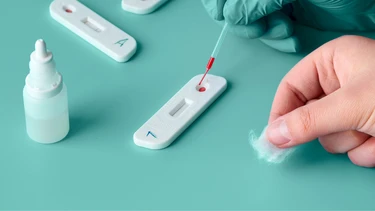 Que thử giang mai có chính xác không? Quy trình và các xét nghiệm giang mai khác