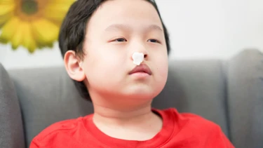 Sốt chảy máu cam ở trẻ: Nguyên nhân, điều trị, phòng ngừa