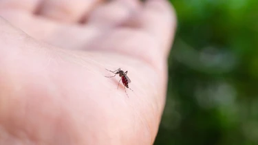 Sốt xuất huyết có lây từ người sang người không và cơ chế lây truyền cần biết