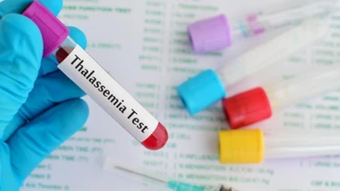 Thalassemia di truyền không? Cách phòng ngừa và kiểm soát bệnh