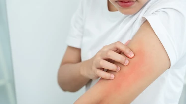Uống thuốc trị sán chó vẫn bị ngứa phải làm sao? Khi nào cần đi khám lại?