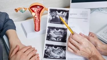 Viêm lộ tuyến cổ tử cung độ 2: Dấu hiệu nhận biết và cách điều trị hiệu quả