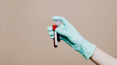 Xét nghiệm HAV IgM test: Khi nào cần làm để phát hiện viêm gan A sớm?