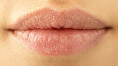  Nguyên nhân bị khô môi khi mang thai và cách cải thiện an toàn
