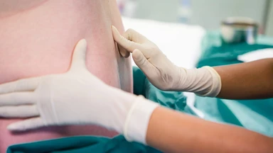 Có nên gây tê ngoài màng cứng khi sinh thường để giảm đau?