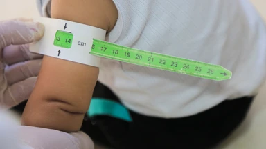 Trẻ suy dinh dưỡng thấp còi nên bổ sung gì để hỗ trợ tăng trưởng? 