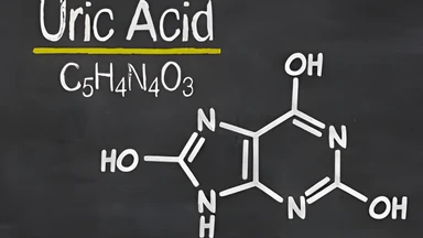 Ăn gì giảm axit uric? Gợi ý xây dựng chế độ ăn