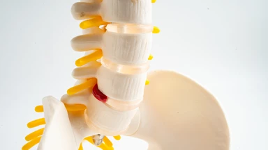 Các bài tập cho phồng đĩa đệm tại nhà và những lưu ý cần biết