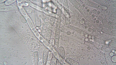 benh_a_z_benh_cyclosporiasis1_bcf7c0e25c