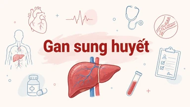 Gan sung huyết là gì? Nguyên nhân và cách phòng ngừa hiệu quả