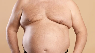 Bệnh Gynecomastia là gì? Những điều cần biết về bệnh Gynecomastia
