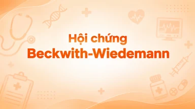 Hội chứng Beckwith-Wiedemann là gì? Nguyên nhân và cách phòng ngừa hiệu quả