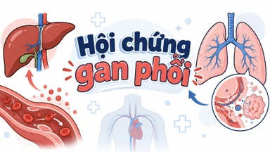 benh_a_z_hoi_chung_gan_phoi_1_723d03755a
