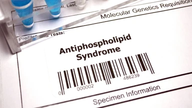 Hội chứng kháng phospholipid là gì? Nguyên nhân và cách phòng ngừa hiệu quả