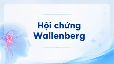 Hội chứng Wallenberg là gì? Nguyên nhân và cách phòng ngừa hiệu quả