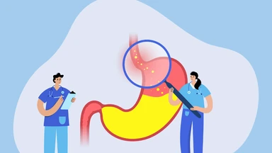 Viêm thực quản là gì? Triệu chứng, nguyên nhân và cách điều trị bệnh