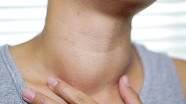 Bướu cổ và u tuyến giáp: Nguyên nhân, dấu hiệu và cách nhận biết