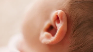 Các dạng bất thường vành tai bẩm sinh thường gặp: Nguyên nhân, phân loại và cách điều trị