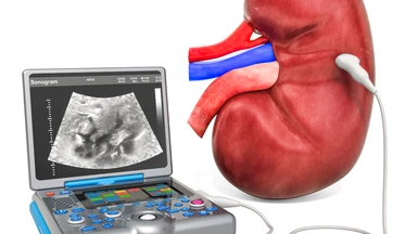 Cách kiểm tra thận yếu tại nhà và các xét nghiệm giúp đánh giá chức năng thận
