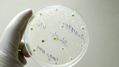 candida_albicans_la_gi_nguyen_nhan_gay_benh_va_cach_phong_ngua_1_5ce5e126d7