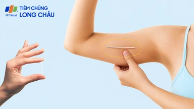 Cấy que tránh thai có được xuất vào trong không?
