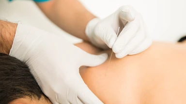 Châm cứu xong có tắm được không? Những điều cần tránh sau khi thực hiện