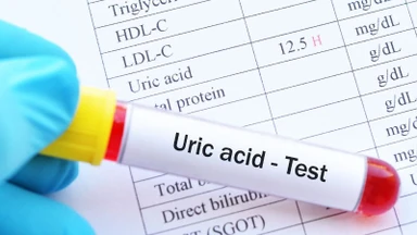 Chỉ số Acid uric là gì? Ý nghĩa và mức bình thường bạn cần biết
