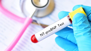 Chỉ số NT-proBNP là gì? Ý nghĩa, mức bình thường và khi nào cần xét nghiệm