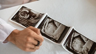 Chửa ngoài tử cung thể huyết tụ thành nang là gì? Dấu hiệu, nguyên nhân và cách điều trị
