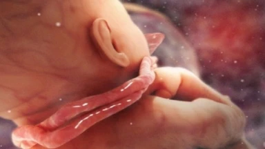Dây rốn quấn cổ 2 vòng có nguy hiểm không? Những điều mẹ bầu cần biết
