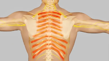 Dây thần kinh liên sườn ở đâu? Cấu tạo, chức năng và bệnh lý thường gặp