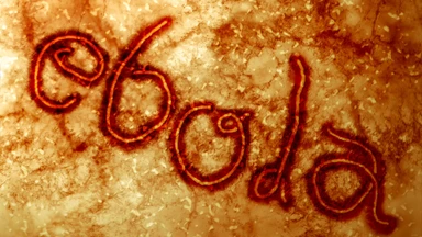 Dịch Ebola đang diễn biến ra sao? Cập nhập tình hình dịch Ebola