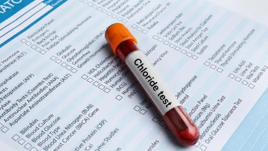 Điện giải đồ Clorid (Cl⁻) là gì? Ý nghĩa của xét nghiệm Clo trong máu