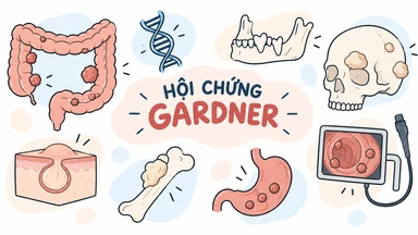 hoi_chung_ardner_png_c36ecd4117