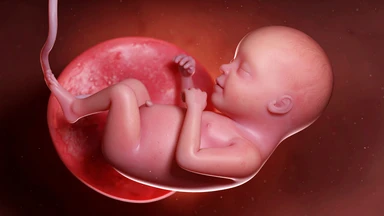 Hội chứng dải sợi ối là gì? Nguyên nhân và dấu hiệu nhận biết sớm