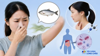 Hội chứng mùi cá: Nguyên nhân và cách kiểm soát